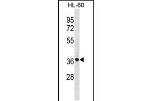 Western blot analysis in HL-60 cell line lysates (35ug/lane). (TNIP2 Antikörper  (AA 165-194))