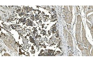 IHC analysis of FLCN using anti-FLCN antibody (ABIN7602491).