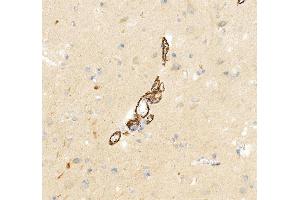 IHC analysis of HTR2A using anti-HTR2A antibody (ABIN3042729).