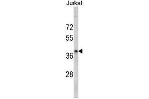 Western blot analysis of RRM2 antibody (Center) in Jurkat cell line lysates (35ug/lane).