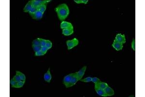 Immunofluorescence staining of PC-3 cells with ABIN7151823 at 1:50, counter-stained with DAPI.