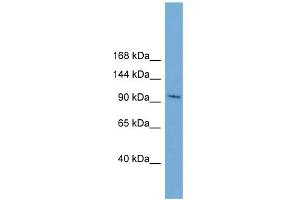 WB Suggested Anti-STK31 Antibody Titration:  0.