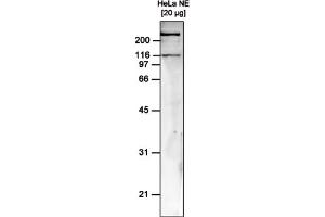 Western Blot of anti-hSNF2H antibody Western Blot results of mouse anti-hSNF2H antibody. (SMARCA5 Antikörper)