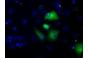 Image no. 2 for anti-Aldehyde Dehydrogenase 3 Family, Member A1 (ALDH3A1) antibody (ABIN1496591) (ALDH3A1 Antikörper)