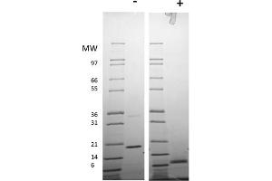 SDS-PAGE (SDS) image for Resistin Dimer protein (ABIN6700462)