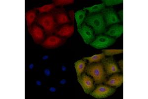 ABIN6263848 and ABIN6278604 staining  cells by IF/ICC.