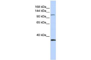 WB Suggested Anti-MCM2 Antibody Titration:  0. (MCM2 Antikörper  (Middle Region))