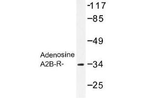 Image no. 1 for anti-Adenosine A2b Receptor (ADORA2B) antibody (ABIN317695) (Adenosine A2b Receptor Antikörper)