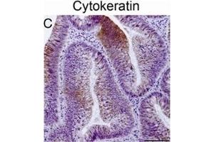 Immunohistochemistry (IHC) image for anti-Keratin 20 (KRT20) antibody (ABIN2856768)