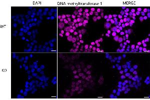 Immunocytochemical staining of Hela cells using DNA methyltransferase 1 antibody (ABIN7798362), 1:1,000), Top panel: wild-type (WT), Bottom panal: DNA methyltransferase 1 shRNA knockdown (KD). (Rekombinanter DNMT1 Antikörper)