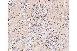 ABIN6267404 at 1/200 staining human kidney tissue sections by IHC-P. (Stathmin 1 Antikörper  (pSer15))