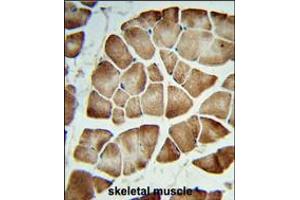 Formalin-fixed and paraffin-embedded human skeletal muscle reacted with COQ3 Antibody , which was peroxidase-conjugated to the secondary antibody, followed by DAB staining.
