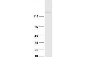 Validation with Western Blot (RGS3 Protein (Transcript Variant 4) (Myc-DYKDDDDK Tag))