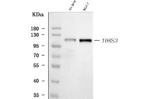 Western blot analysis of THBS3 using anti-THBS3 antibody (ABIN7600759). (THBS3 Antikörper  (AA 23-486))