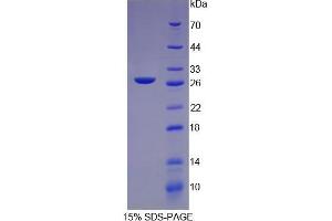 SDS-PAGE (SDS) image for C-Reactive Protein (CRP) (AA 20-230) protein (His tag) (ABIN1098917)