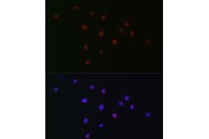 Immunofluorescence analysis of C6 cells using SOX10 Rabbit pAb (ABIN6134484, ABIN6148289 and ABIN7101829) at dilution of 1:100 (40x lens). (SOX10 Antikörper)