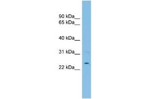WB Suggested Anti-UBE2E3 Antibody Titration:  0. (UBE2E3 Antikörper  (N-Term))