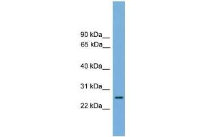 Human heart; WB Suggested Anti-RAB35 Antibody Titration: 0. (RAB35 Antikörper  (Middle Region))