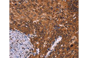 Immunohistochemistry (IHC) image for anti-CDC5 Cell Division Cycle 5-Like (S. Pombe) (CDC5L) antibody (ABIN5544110) (CDC5L Antikörper)