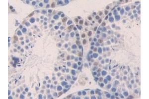 Immunohistochemistry (IHC) image for anti-Chemokine (C-C Motif) Ligand 4 (CCL4) (AA 24-92) antibody (ABIN7430945)