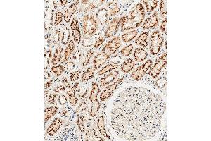 Immunohistochemical analysis of paraffin-embedded Human kidney tissue using (ABIN654433 and ABIN2844169) performed on the Leica® BOND RXm. (CTSA Antikörper  (N-Term))