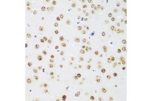 Immunohistochemistry of paraffin-embedded mouse brain using MECP2 antibody. (MECP2 Antikörper)
