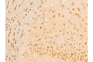 ABIN6267236 at 1/100 staining mouse brain tissue sections by IHC-P. (MAP3K7 Antikörper  (pThr187))
