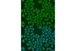 Immunofluorescence analysis of U2OS cells using AKR7A3 antibody. (AKR7A3 Antikörper  (AA 1-331))