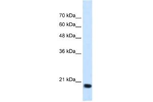 WB Suggested Anti-SSR2 Antibody Titration:  1. (SSR2 Antikörper  (N-Term))
