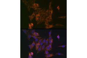 Immunofluorescence analysis of NIH/3T3 cells using LPP Rabbit mAb (ABIN7268284) at dilution of 1:100 (40x lens). (LPP Antikörper)