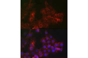 Immunofluorescence analysis of  cells using TROP-2 Rabbit pAb (ABIN7271104) at dilution of 1:100 (40x lens). (TACSTD2 Antikörper  (AA 27-270))