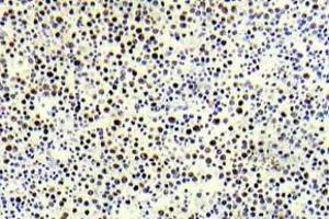 Immunohistochemistry (IHC) analyzes of p-Histone H3. (Histone H3.1 Antikörper  (pThr3))