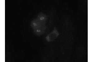Image no. 1 for anti-Budding Uninhibited By Benzimidazoles 1 Homolog (Yeast) (BUB1) (AA 281-419) antibody (ABIN108553)
