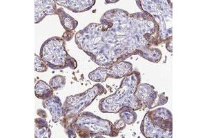 Immunohistochemical staining of human placenta with CRB2 polyclonal antibody  shows strong membranous and cytoplasmic positivity in trophoblastic cells. (CRB2 Antikörper)