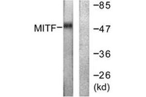 Western blot analysis of extracts from HepG2 cells, using MITF (Ab-180/73) Antibody.