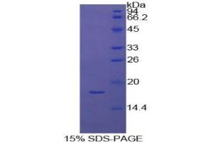 SDS-PAGE analysis of Cow Coagulation Factor IX Protein. (Coagulation Factor IX Protein (F9))