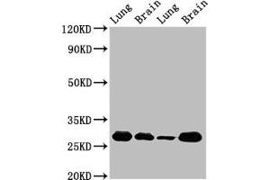 Western Blot Positive WB detected in: Rat lung tissue, Rat brain tissue, Mouse lung tissue, Mouse brain tissue All lanes: SFN antibody at 5 μg/mL Secondary Goat polyclonal to rabbit IgG at 1/50000 dilution Predicted band size: 28, 25 kDa Observed band size: 28 kDa (14-3-3 sigma/SFN Antikörper  (AA 1-248))