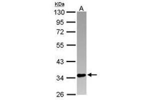 Image no. 1 for anti-PIN2/TERF1 Interacting, Telomerase Inhibitor 1 (PINX1) (AA 1-221) antibody (ABIN1500224) (PINX1 Antikörper  (AA 1-221))