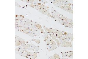 Immunohistochemistry of paraffin-embedded mouse heart using KDM4A antibody (ABIN5975678) at dilution of 1/100 (40x lens). (KDM4A Antikörper)