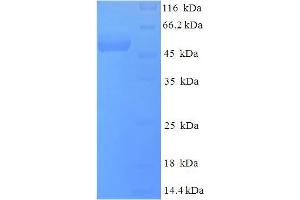SDS-PAGE (SDS) image for Deoxyuridine Triphosphatase (DUT) (AA 1-278), (full length) protein (His-SUMO Tag) (ABIN5710750) (Deoxyuridine Triphosphatase (DUT) (AA 1-278), (full length) protein (His-SUMO Tag))