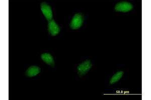 Immunofluorescence of purified MaxPab antibody to MAP2K4 on HeLa cell. (MAP2K4 Antikörper  (AA 1-399))