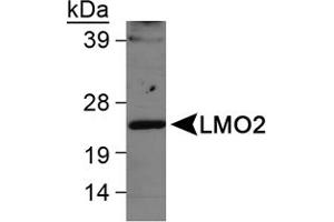 Western blot analysis of LMO2 in Ramos whole cell lysate using LMO2 polyclonal antibody . (LMO2 Antikörper  (AA 1-100))
