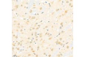 Immunohistochemistry of paraffin embedded rat brain using Arhgap17 (ABIN7075416) at dilution of 1: 700 (400x lens) (ARHGAP17 Antikörper)