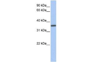 WB Suggested Anti-GALE Antibody Titration: 0. (GALE Antikörper  (N-Term))