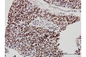 Immunostaining (ISt) image for anti-Chromodomain Helicase DNA Binding Protein 4 (CHD4) (AA 1632-1730) antibody (ABIN560357)