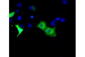 Immunofluorescence (IF) image for anti-Bruton Agammaglobulinemia tyrosine Kinase (BTK) antibody (ABIN1496978) (BTK Antikörper)