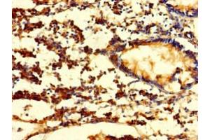 Immunohistochemistry of paraffin-embedded human appendix tissue using ABIN7152778 at dilution of 1:100