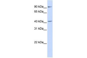 Western Blot showing SOX17 antibody used at a concentration of 1-2 ug/ml to detect its target protein. (SOX17 Antikörper  (Middle Region))