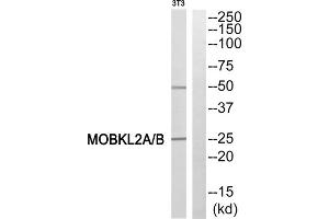 Western blot analysis of extracts from 3T3 cells, using MOBKL2A/B antibody. (MOBKL2A,B (N-Term) Antikörper)