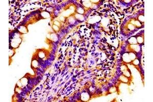 Immunohistochemistry of paraffin-embedded human small intestine tissue using ABIN7161709 at dilution of 1:100 (Norrie Disease (Pseudoglioma) Antikörper  (AA 25-133))